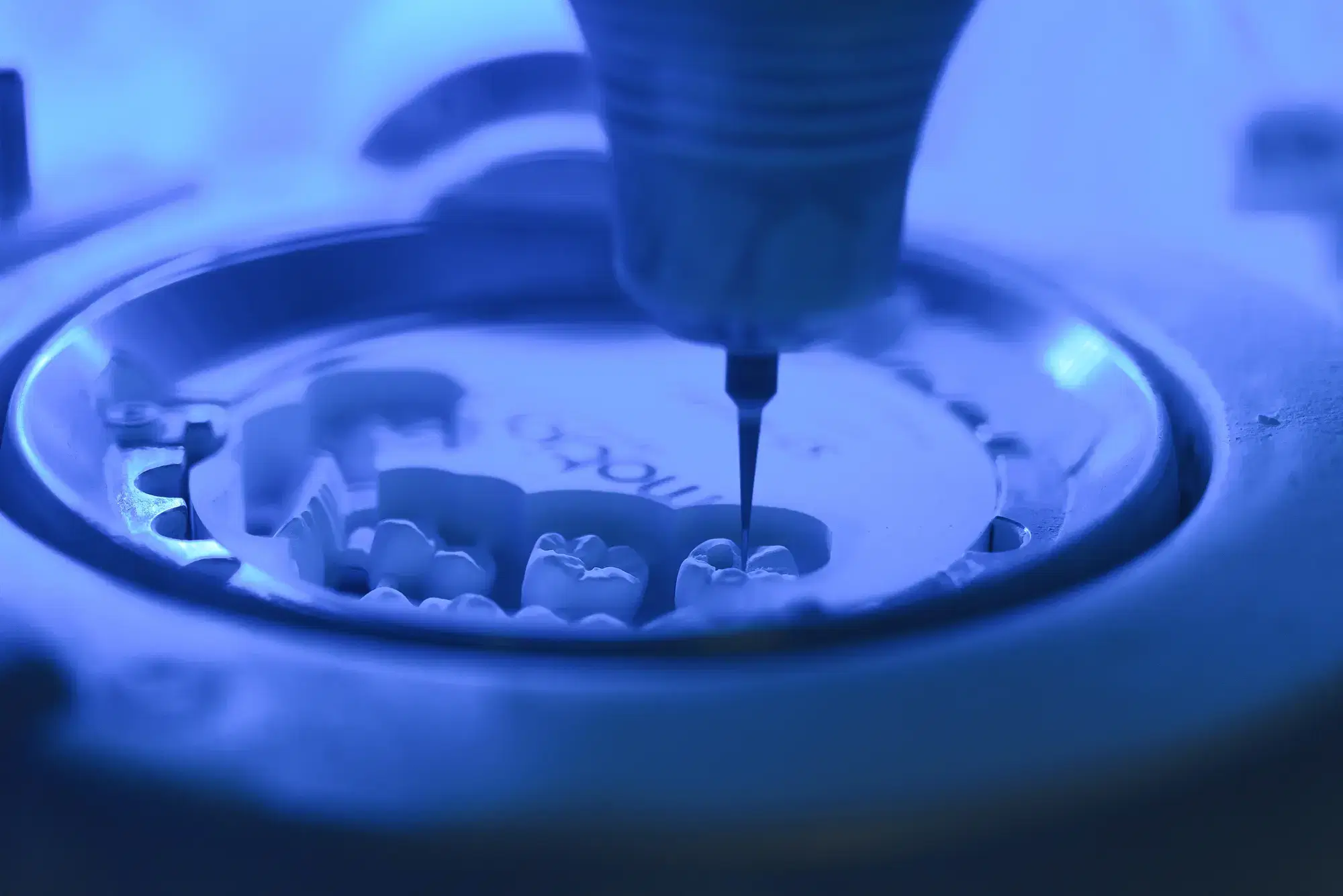 طحن CAD/CAM للسيراميك على أساس المسوحات الرقمية